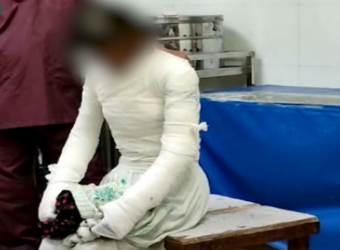 রাজধানীর বসুন্ধরায় নির্যাতনে ঝলসে গেছে কিশোরী গৃহকর্মী